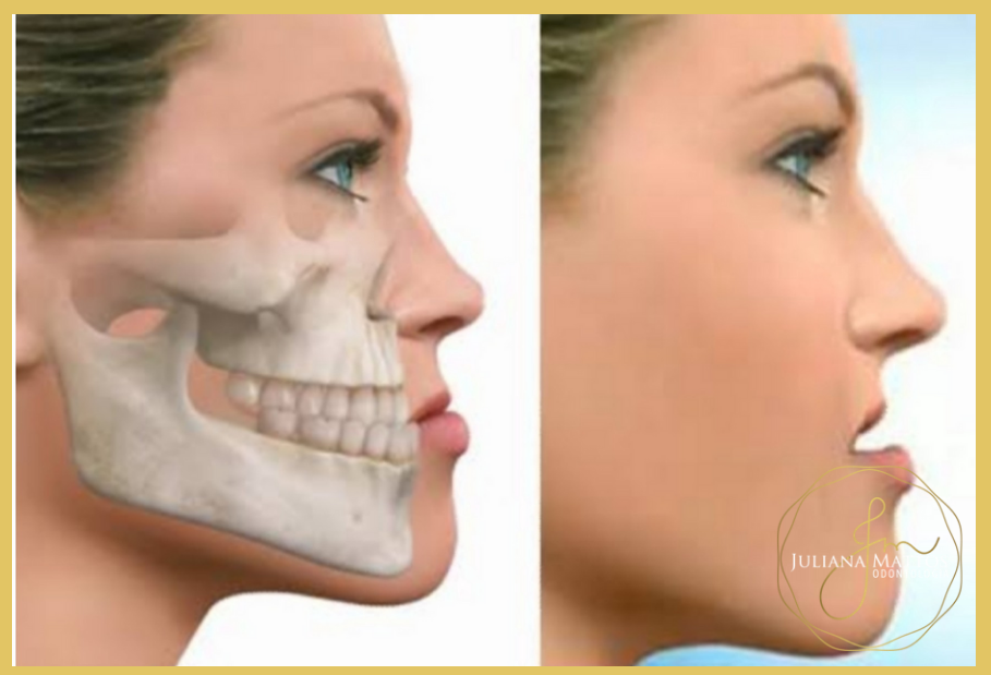 Relações maxila e mandíbula em dentados 